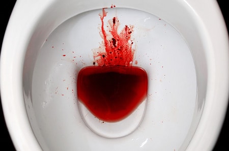 blood in stool